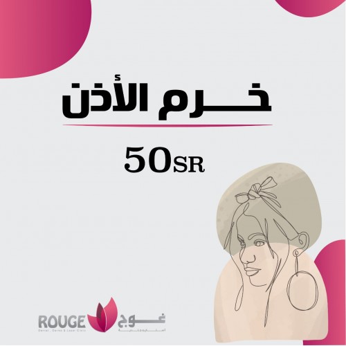 خرم الأذن خرم الأذن